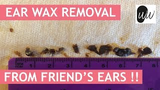 Ear Wax Removal from FRIENDS Ear   372 [upl. by Dewain]