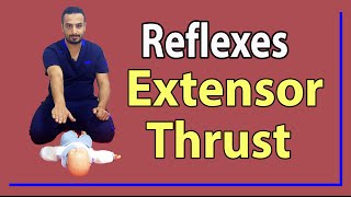 02 Extensor Thrust Reflex [upl. by Durston520]