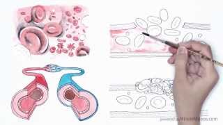 Platelet Rich Plasma PRP  A short Introduction [upl. by Alfonso]