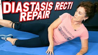 Top 5 Exercises to REPAIR Diastasis Recti [upl. by Scotney602]