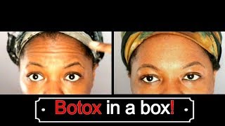 Botox in a Box Loreal Bright Reveal Review Wrinkle Treatment [upl. by Yks]