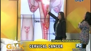 Understanding Cervical Cancer [upl. by Ecinad]