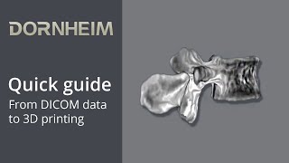 quick guide  From DICOM data to 3D printing [upl. by Ellerad568]