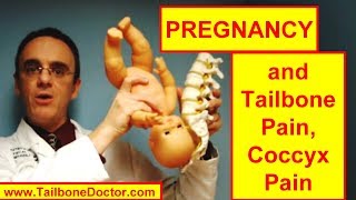 TAILBONE PAIN During PREGNANCY [upl. by Mloclam]