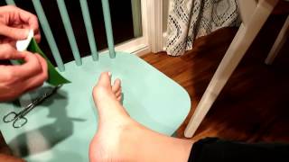 Pain in the big toe joint treatment of sprain and sesamoid injury with taping [upl. by Ardyth946]