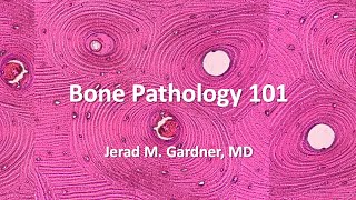 Bone Tumor Pathology 101 Osteosarcoma Chondrosarcoma and Mimics [upl. by Nylrac513]