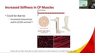 the impact of collagenase on passive and active properties of muscles in children with CP by F Syed [upl. by Llebana]