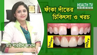 ফাঁকা দাঁতের চিকিৎসা ও খরচ  Faka Dater Treatment amp Cost  Treatment and cost of empty teeth [upl. by Sessylu]