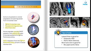 Comprehensive Guide to Fetal Echocardiography of the Fetal Aorta [upl. by Aromas456]