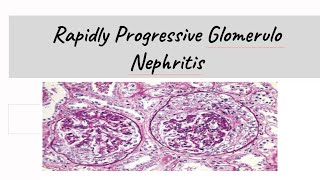 Rapidly Progressive Glomerulonephritis  RPGN [upl. by Enyrb210]