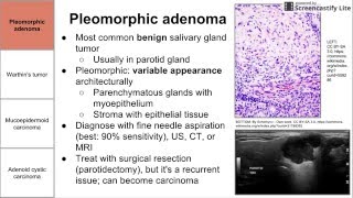 Salivary Gland Neoplasms [upl. by Irpac]