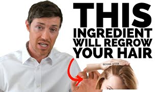 The BEST Hair Supplements Contain This Ingredient [upl. by Lerrud155]