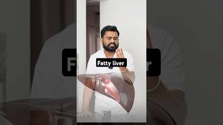 Fatty liver घर के खाने की ताकत को पहचानो drrobin health food ayurved doctor facts remedy [upl. by Morley201]