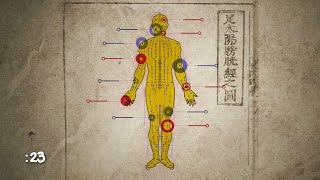 How Does Acupuncture Work  WebMD [upl. by Asselem]