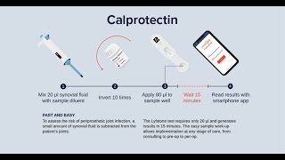 Calprotectin PJI diagnostic [upl. by Hutson]