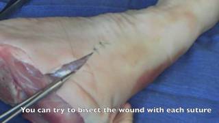 Suture  Basic Technique 2 [upl. by Oterol]