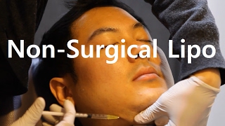 Fat dissolving injections for double chin before and after  Seoul Guide Medical [upl. by Aryaz]