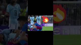 Araujo serious injury 🤕🤕 football fcbarcelona injury [upl. by Thetes]