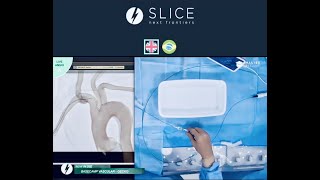 Best of Slice Next Frontiers 2022 🧠⚡ basecamp vascular  bcv systems 🎯 [upl. by Adnilem196]