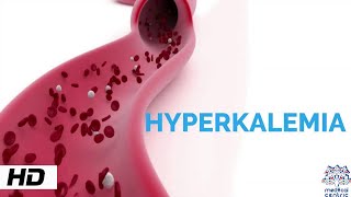 HYPERKALEMIA Causes Signs and Symptoms Diagnosis and Treatment [upl. by Dlonra226]