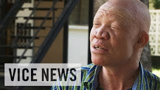 Albino Activism in Tanzania VICE News Meets Josephat Torner [upl. by Drucie]