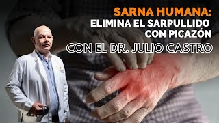 ¿Cuáles son los síntomas de la sarna humana II Parte Médico con Julio Castro [upl. by Elyse]