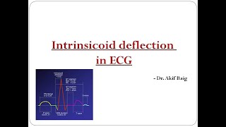 Intrinsicoid deflection in ECG  DrAkif Baig [upl. by Ferreby]