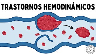 TRASTORNOS HEMODINÁMICOS Hiperemia Congestión Edema Efusión Hemostasia Trombosis y Embolismo [upl. by Jarrod]