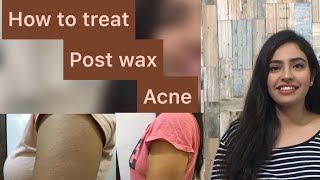 How To Treat ACNEBUMPSREDNESS after wax Postwax acne treatment  POOJA DHEMBLA [upl. by Ellirpa]