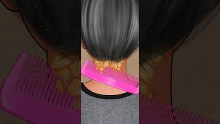 ASMR dandruff removal treatment  remove dandruff amp pimple pus 2d animation [upl. by Karilynn]