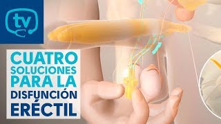 4 soluciones o tratamientos para la disfunción eréctil [upl. by Akihsat]