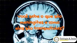 Meningites o que são e como são transmitidas [upl. by Waldon361]