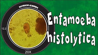 Entamoeba histolyticadispar [upl. by Latin]