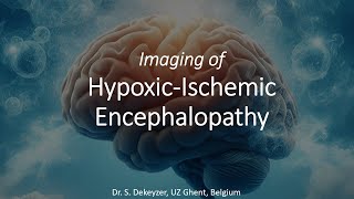 Imaging of HypoxicIschemic Encephalopathy [upl. by Treiber]