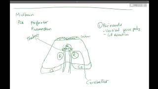 4 Midbrain Strokes [upl. by Annahsat]