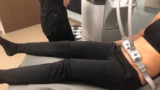 SculpSure Live Demo [upl. by Aisenat448]