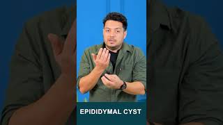 Epididymal Cyst drhealth maleinfertility spermcount himanshudhawan shorts viralshorts [upl. by Nedyrb316]