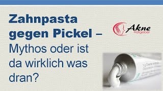 Zahnpasta gegen Pickel und Akne Mythos oder ist da was dran [upl. by Lajes]