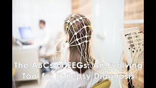 The ABCs of EEGs An Evolving Tool for Epilepsy Diagnosis [upl. by Corder770]