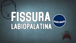 FISSURA LABIOPALATINA  SÉRIE SAÚDE BRASIL [upl. by Caressa]