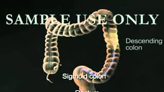 YouTube  3D Medical Animation Lower GI Colonoscopy Sigmoidoscopy [upl. by Justinn143]