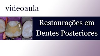 10º Aula Dentística  Restaurações em Dentes Posteriores [upl. by Rez]