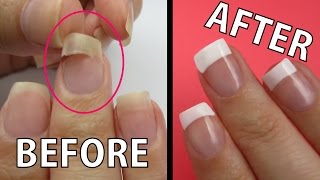 REPAIR A RIPPED NAIL FAST [upl. by Gildus757]