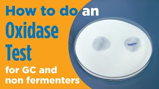 How to perform an Oxidase test in microbiology for gonorrhea and non fermenters [upl. by Ynnaf]