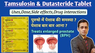 Tamsulosin hydrochloride and dutasteride tablet uses dose side effects in hindi  Urimax d tablet [upl. by Eirallam]