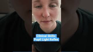 Pupil Light Reflex Clinical Skills  LevelUpRN [upl. by Htiduy]