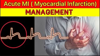 Acute MIMyocardial Infarction Management  Acute STEMI Management  Heart Attack Management in ER [upl. by Perkin]