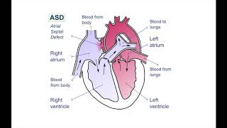 Paediatrics  cardiology [upl. by Colt]