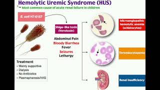 Hemolytic uremic syndrome  HUS  mrcpch Recall Communication [upl. by Nicolle]