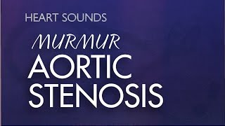 Aortic Stenosis Murmur  With Murmur Sounds Audio Mrrmurs Made Easy [upl. by Lebiram]